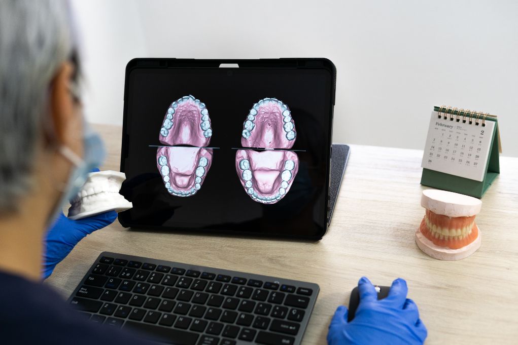 diseño digital en prótesis dentales